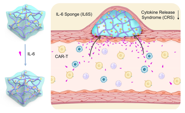 预防CAR-T诱导的细胞因子释放综合征方面获进展