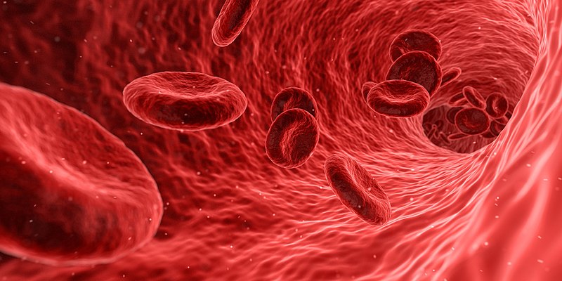 R3 Vascular raises $87M to test its bioresorbable scaffold for blocked arteries below the knee