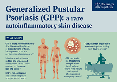 Spesolimab meets primary and key secondary endpoint for prevention of generalized pustular psoriasis flares